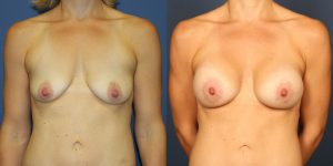 Before and After Image