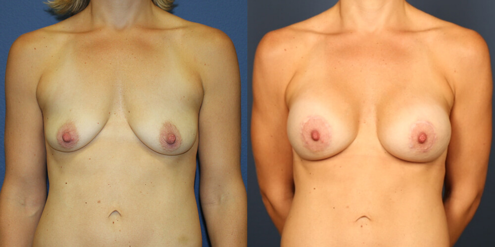 Before and After Image