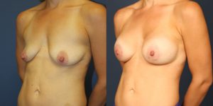 Before and After Image