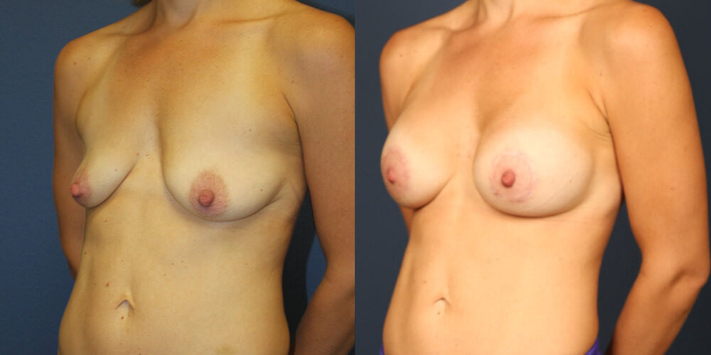 Before and After Image