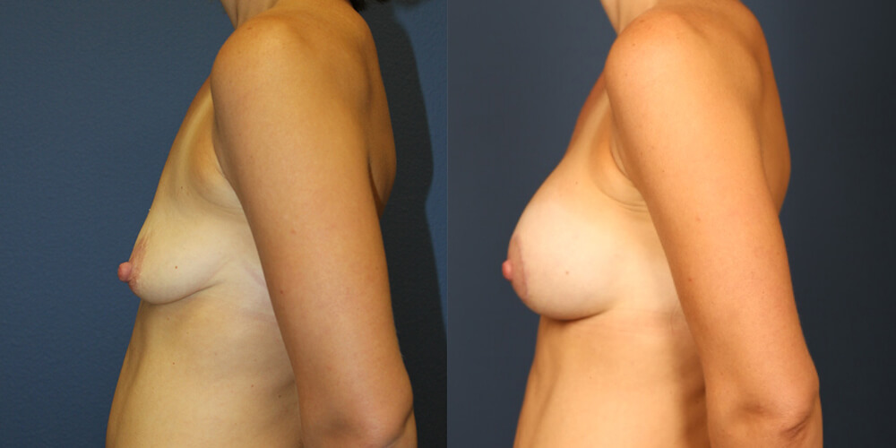 Before and After Image