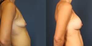 Before and After Image