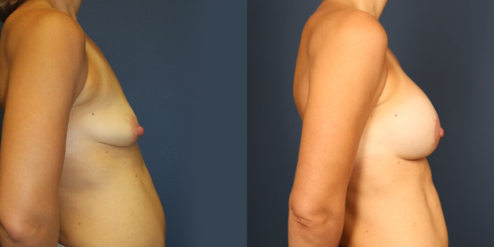 Before and After Image