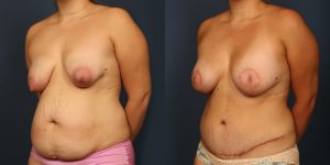 Before and After Image