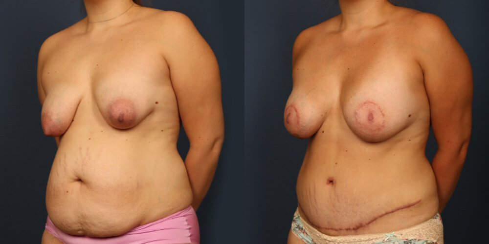 Before and After Image