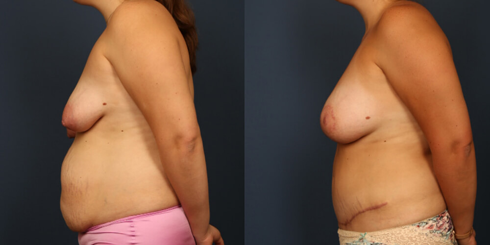 Before and After Image