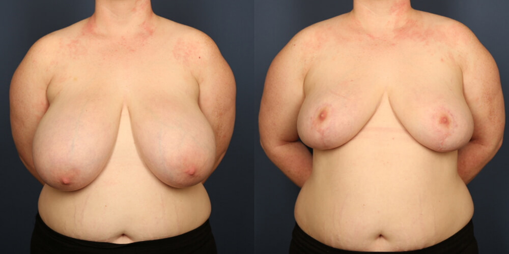 Before and After Image