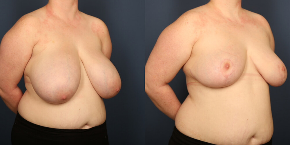 Before and After Image