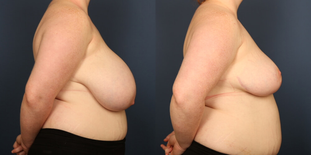 Before and After Image