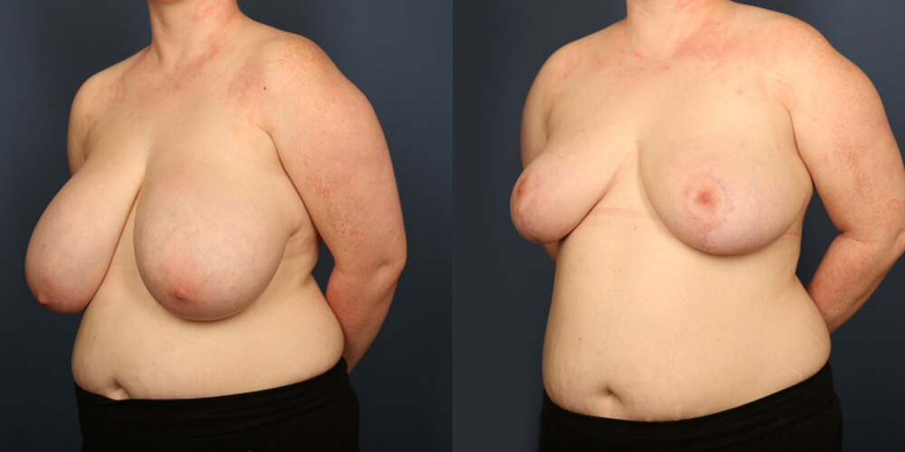 Before and After Image