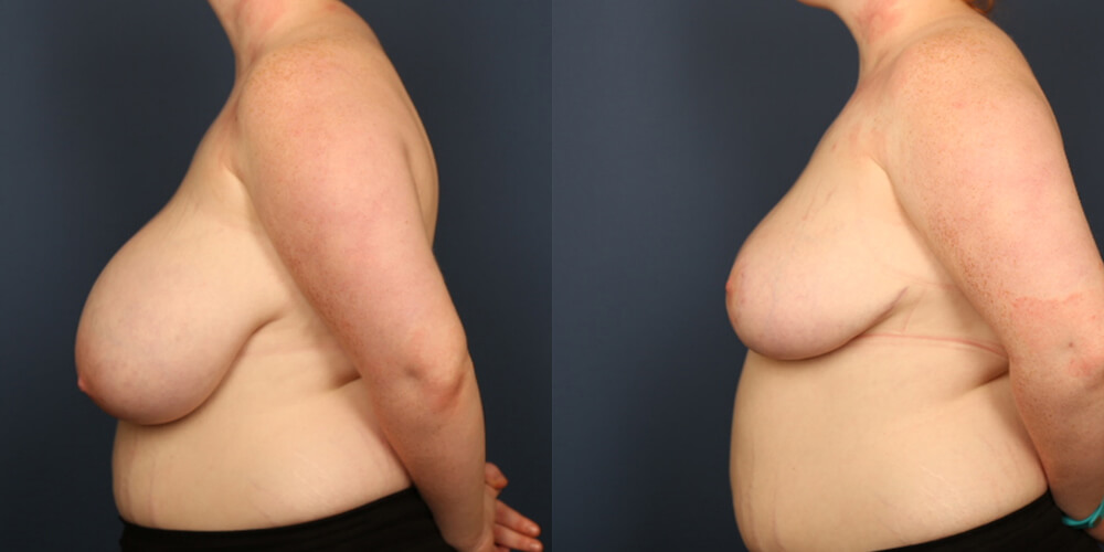 Before and After Image