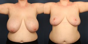 Before and After Image