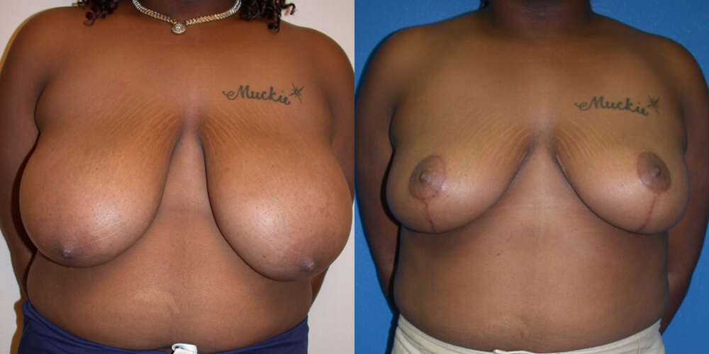 Before and After Image