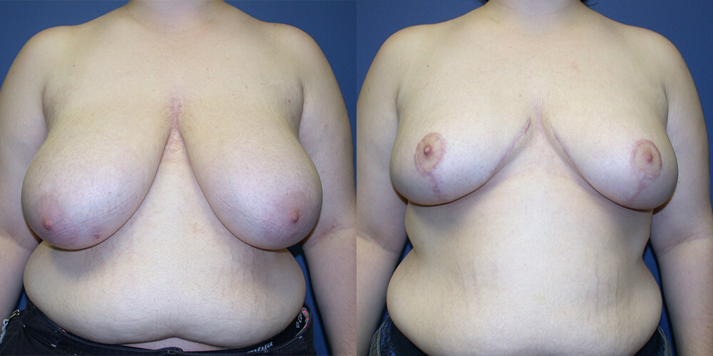 Before and After Image