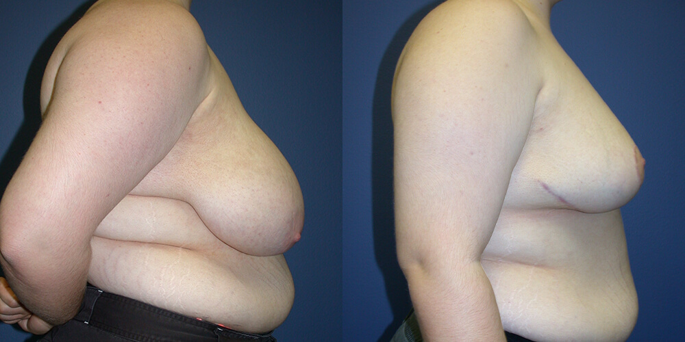 Before and After Image