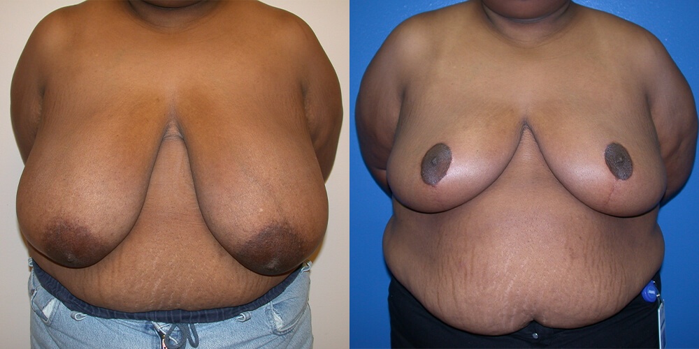 Before and After Image