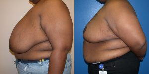 Before and After Image