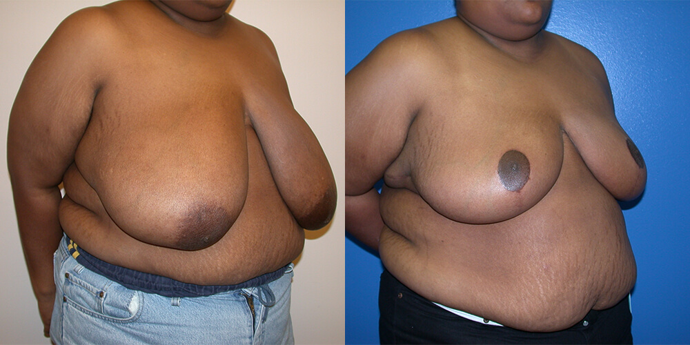 Before and After Image