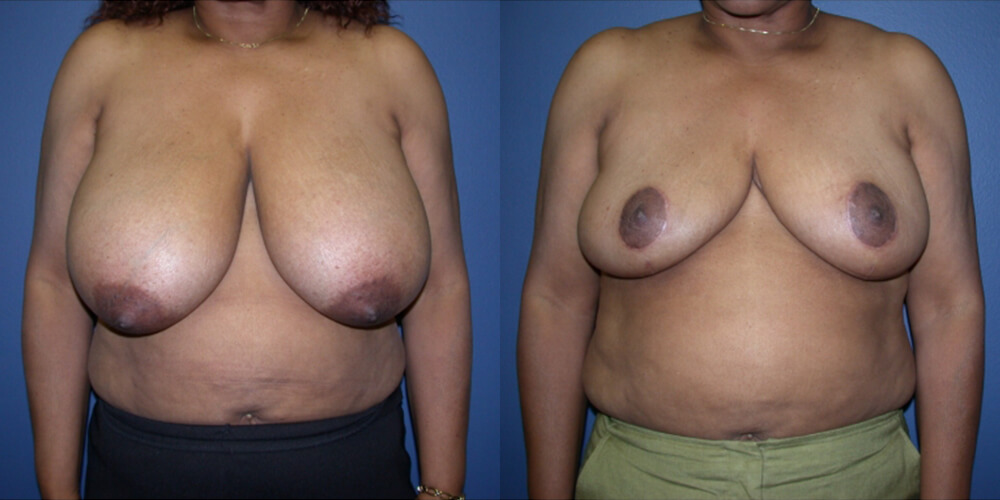 Before and After Image