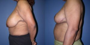 Before and After Image