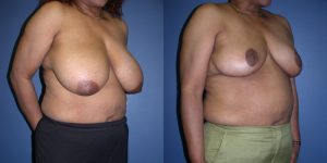 Before and After Image