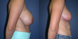 Before and After Image