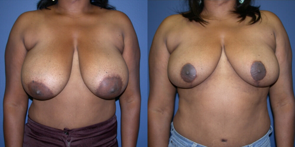 Before and After Image