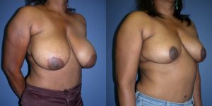 Before and After Image