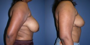 Before and After Image