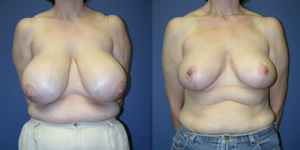 Before and After Image