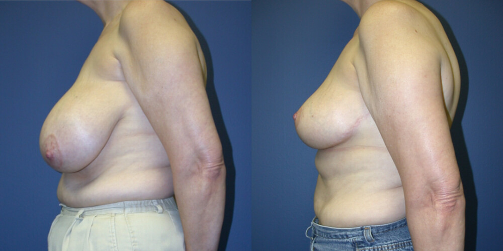 Before and After Image