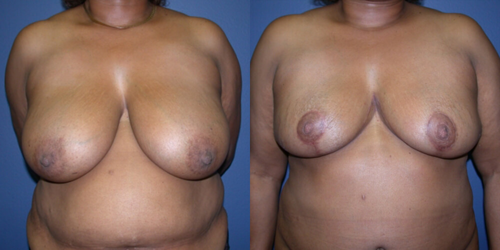 Before and After Image