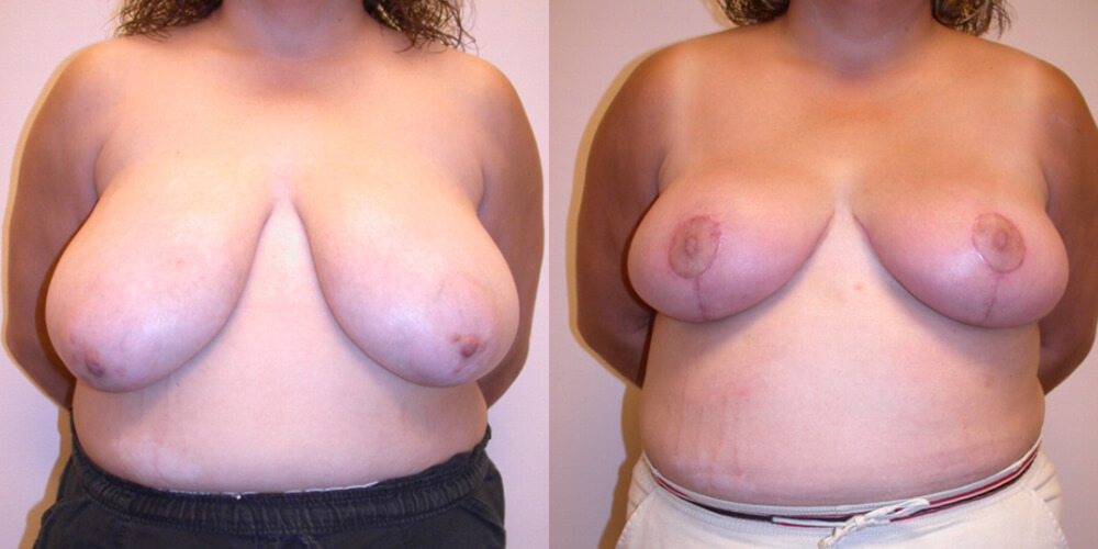 Before and After Image