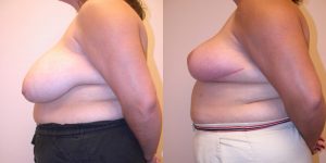 Before and After Image