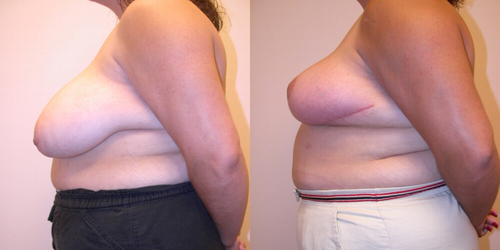 Before and After Image