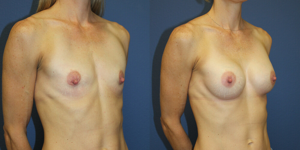 Before and After Image