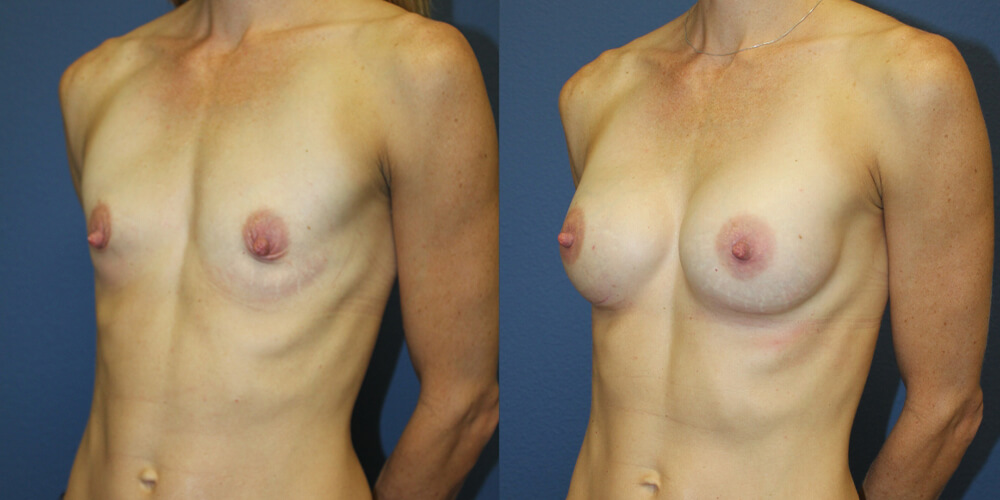 Before and After Image