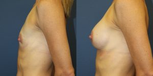 Before and After Image