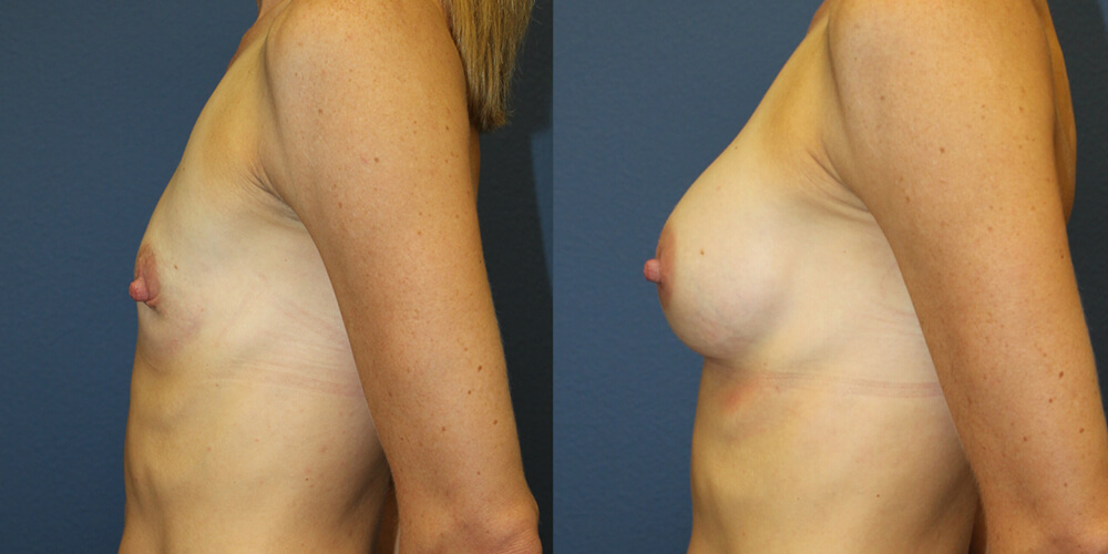 Before and After Image