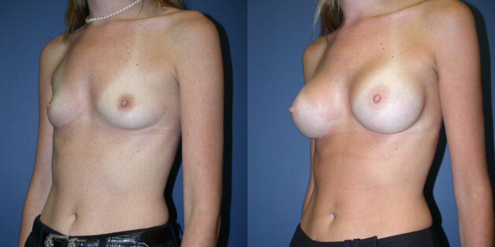 Before and After Image