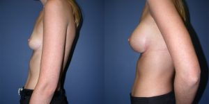 Before and After Image