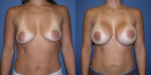 Before and After Image