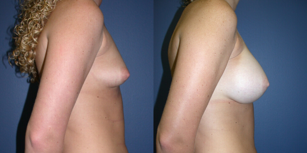 Before and After Image