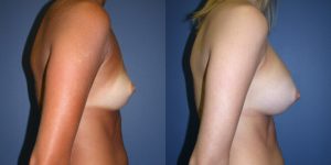 Before and After Image