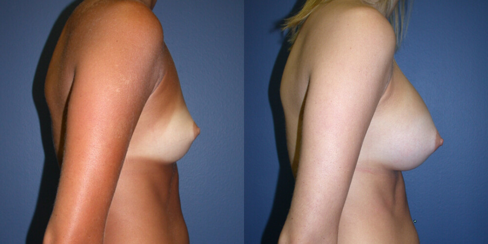 Before and After Image