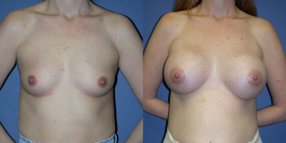 Before and After Image