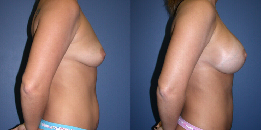 Before and After Image