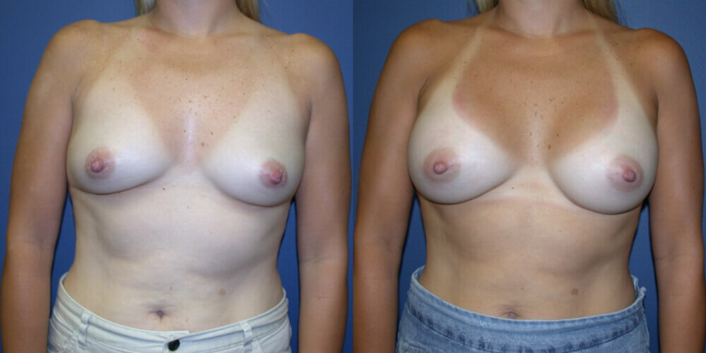 Before and After Image