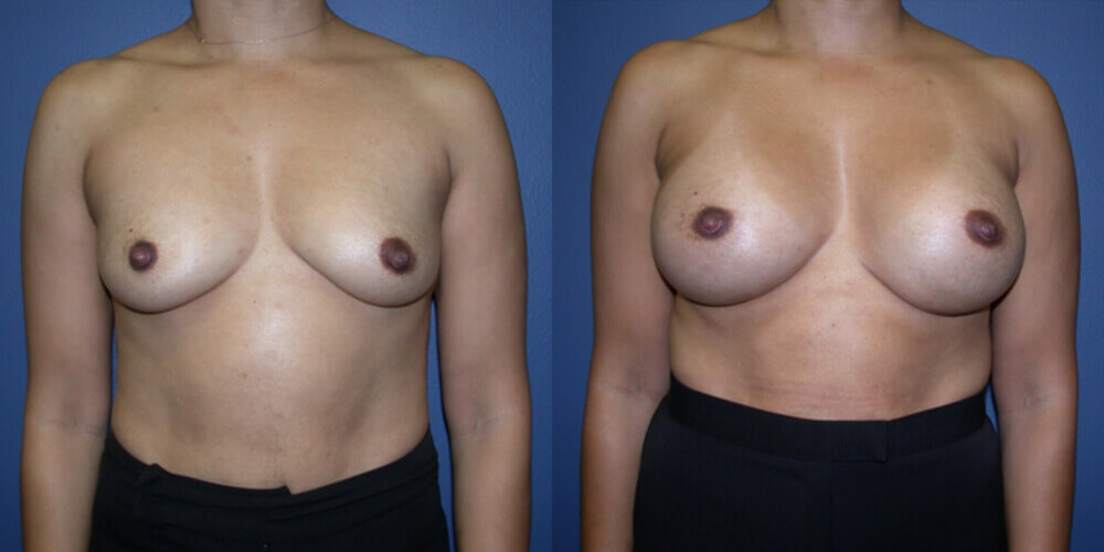 Before and After Image