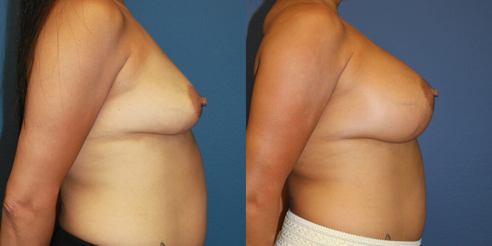 Before and After Image